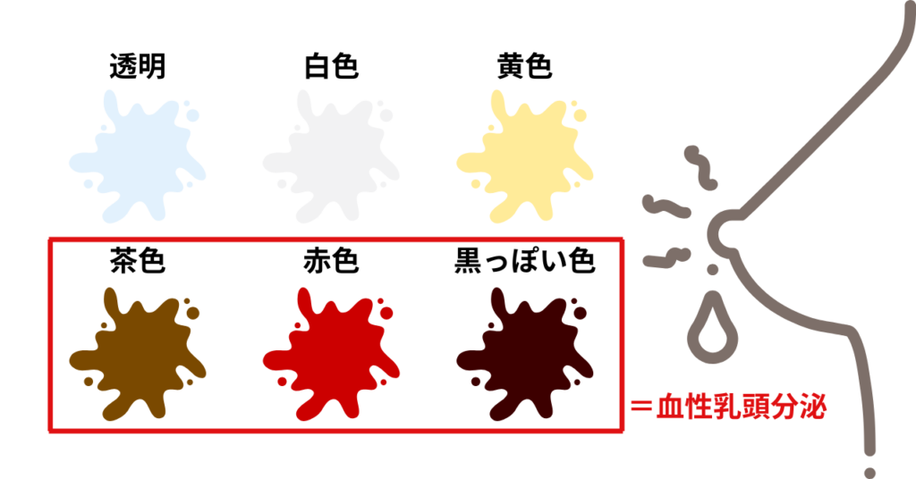血性乳頭分泌