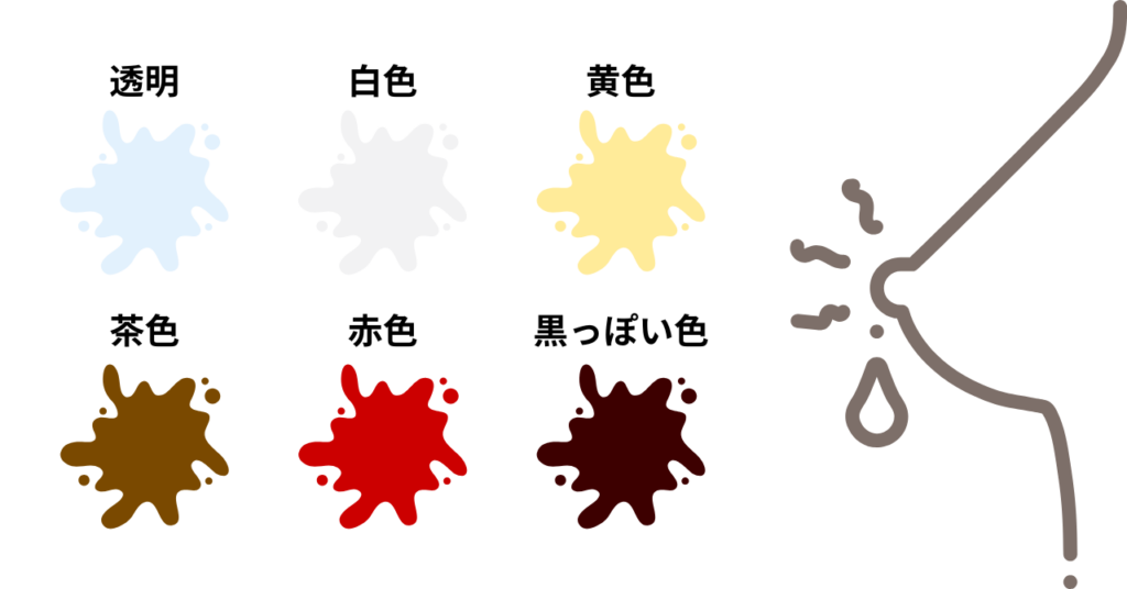 乳頭分泌