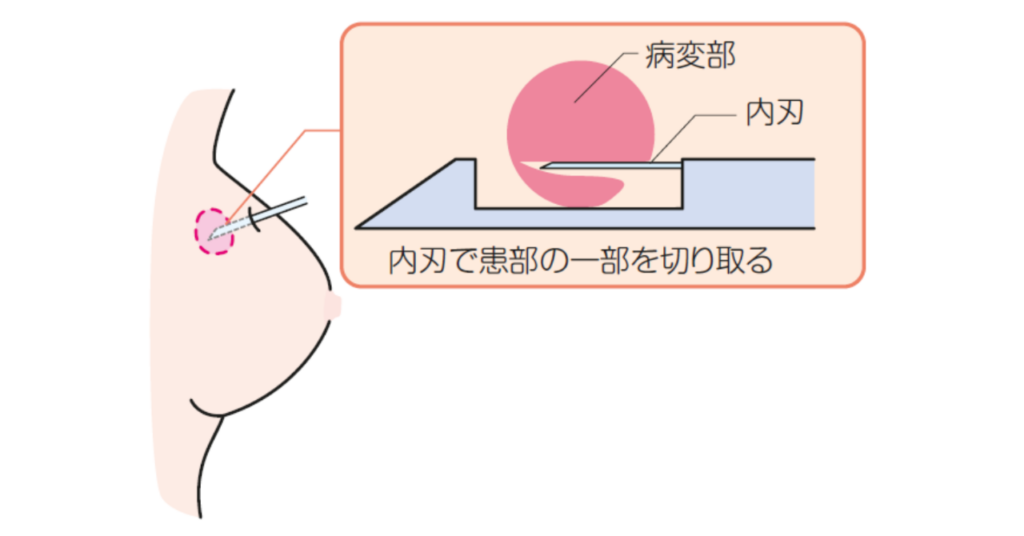 生検